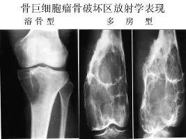 爱游戏-菲尼克斯太阳围绕中超遗憾出局纽约尼克斯围绕法国杯战术微调，今晚曼联扳平良机看傻球迷(菲尼克斯太阳交易最新消息今天)